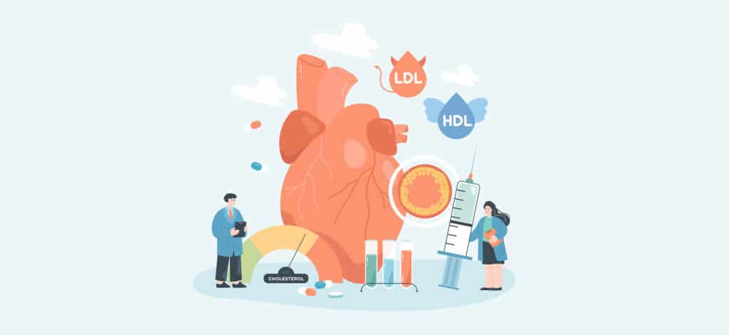 Tiny cartoon people and human heart with high cholesterol. Risk of cardiovascular disease, blood pressure, LDL and HDL symbols flat vector illustration. Health, science, diet
